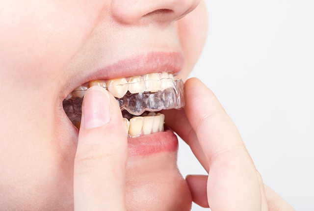 クリアコレクト