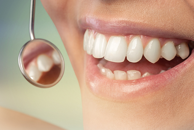 インプラントと他の治療法の違い